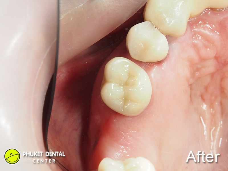 Phuket Dental Center